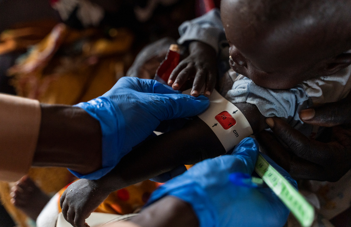 Un niño es evaluado por desnutrición en un centro de salud del campamento de Um Sagour, en Sudán. Un niño es evaluado por desnutrición en un centro de salud del campamento de Um Sagour, en Sudán.